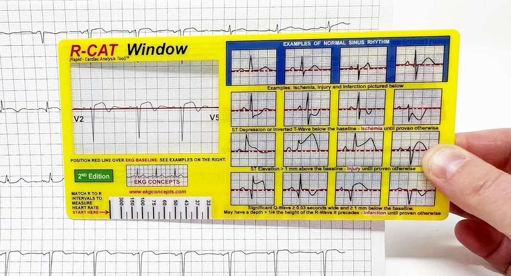EKG Window: Second Edition