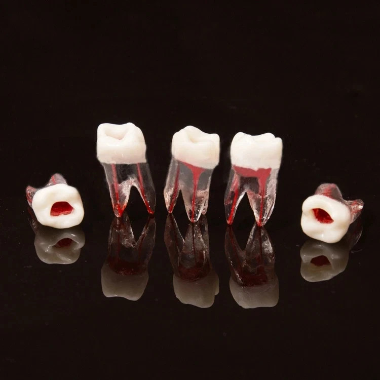5Pcs Dental Tooth Endo Root Canal Study Model For RCT Practice Block Pulp Cavity