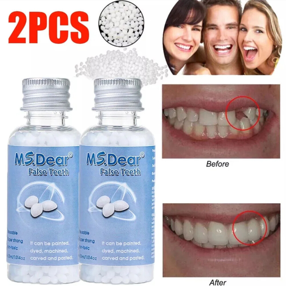 2× Tooth Repair Kit, Temporary Teeth Replacement Kit for Missing & Broken Teeth