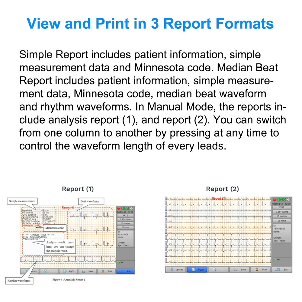Biocare 12 lead ECG Machine Portable with Au-to Analysis Diagnosis ECG, Printer