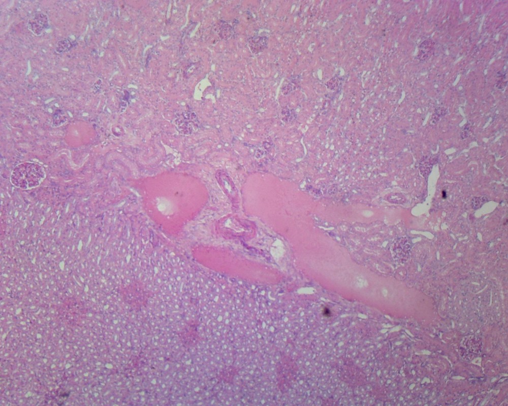 Kidney, Human; Section