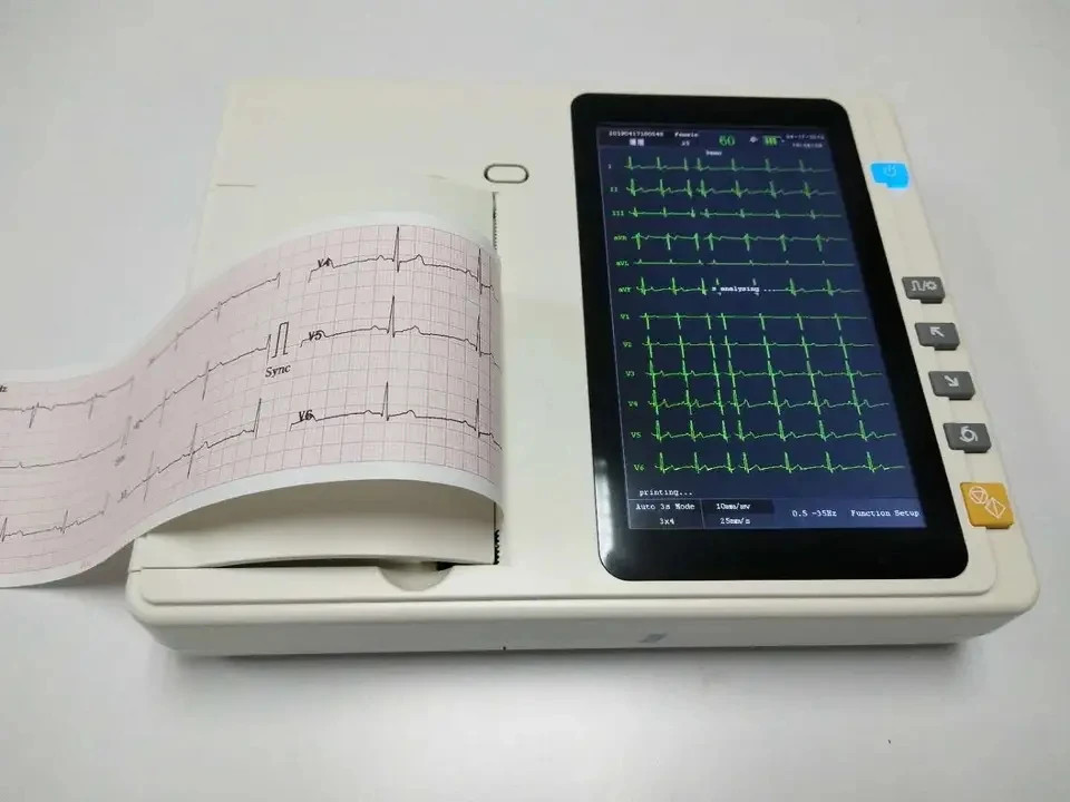 12-Lead ECG Machine, 7" Touch Screen, 3-Channel Electrocardiograph Device