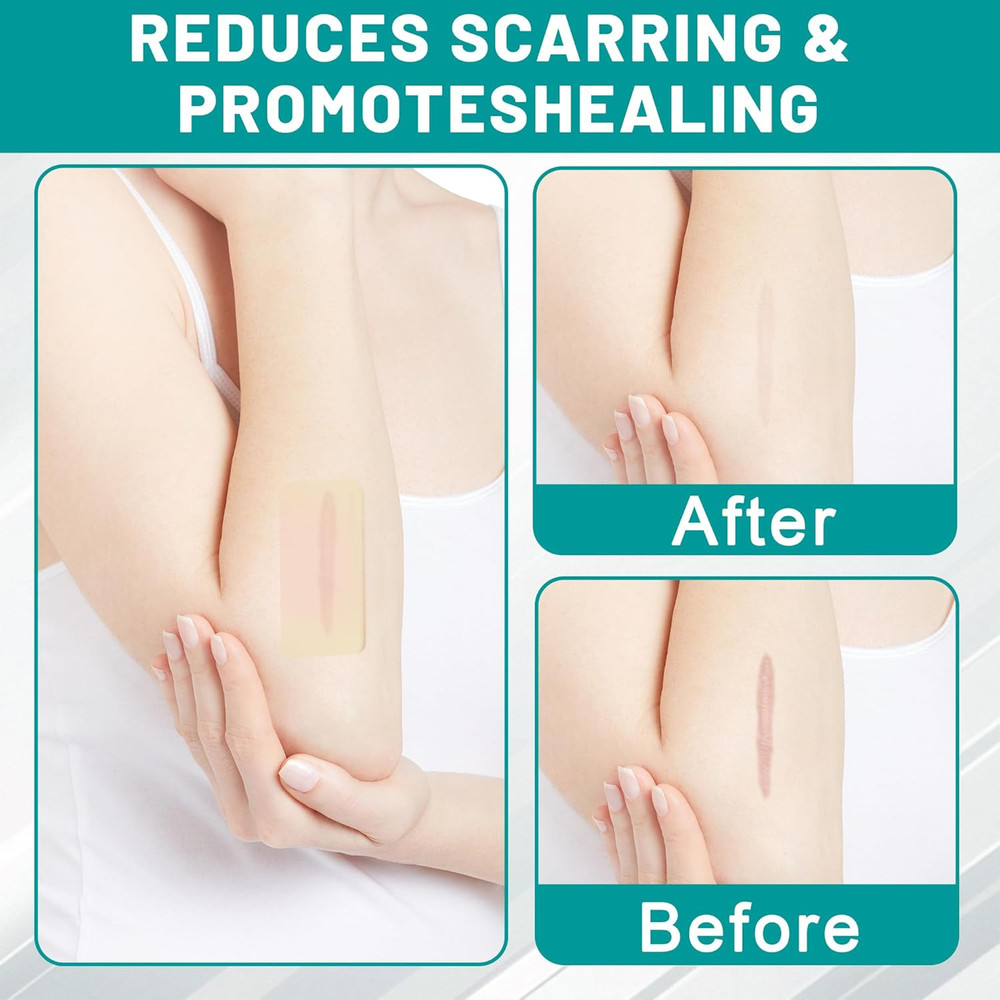 Hydrocolloid Roll, Extra Large Hydrocolloid Bandages, Pimple Patch Roll for Acne