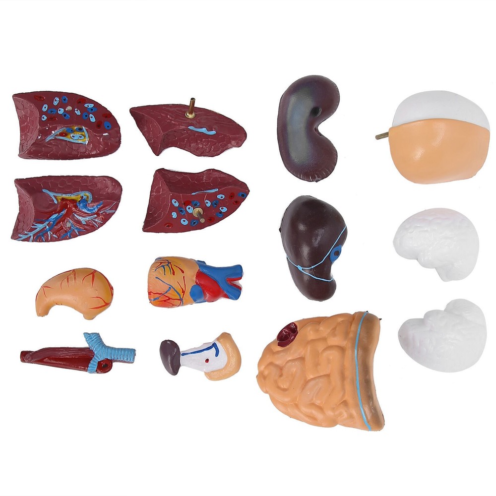 28cm Human Torso Model Detachable Internal Organs Teaching Anatomical Assembly