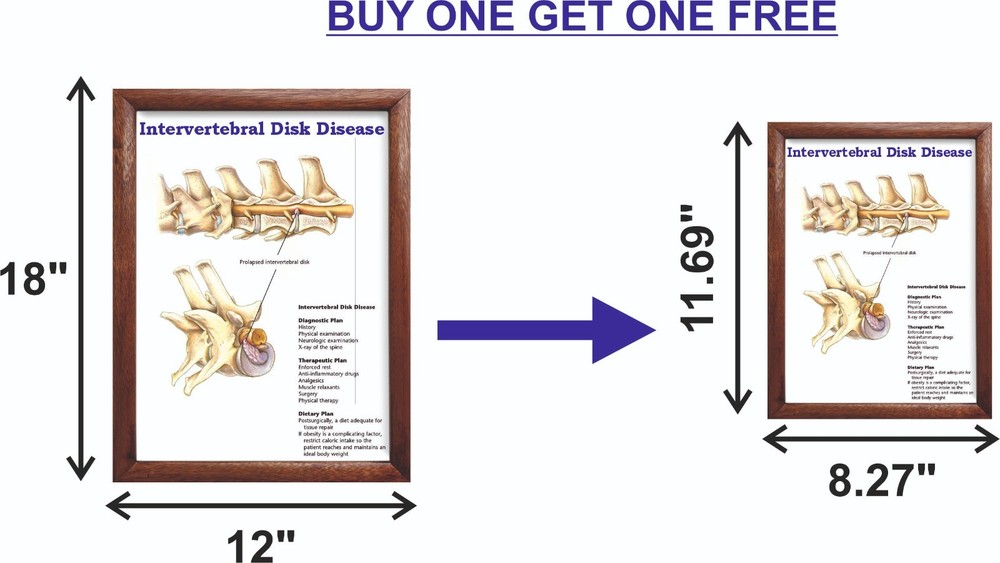 Intervertebral Disk Disease Chart 12x18 inches