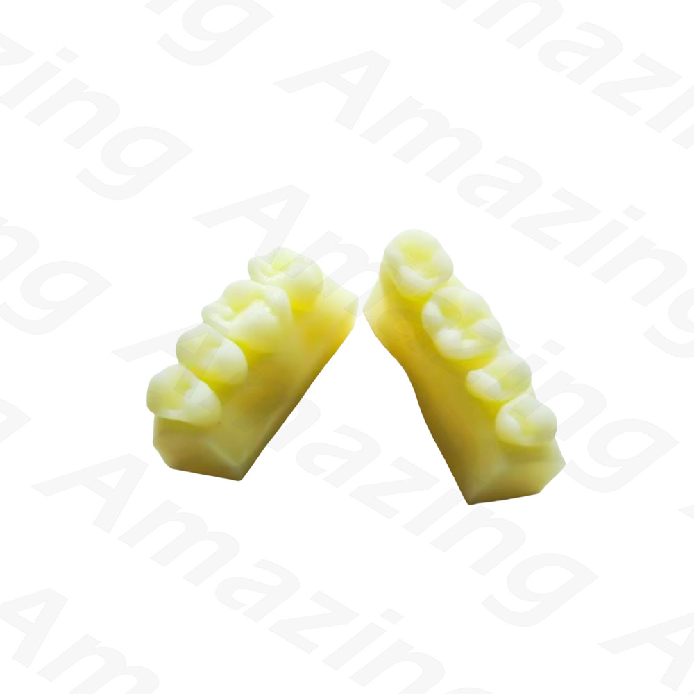 Dental Caries Decay Teeth Model Composite Resin Restore Tooth Simulate Class II