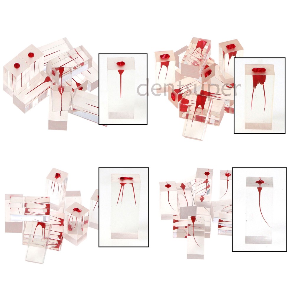 Dental Endo Root Canal Teeth Model Study Practice Block RCT Pulp Cavity