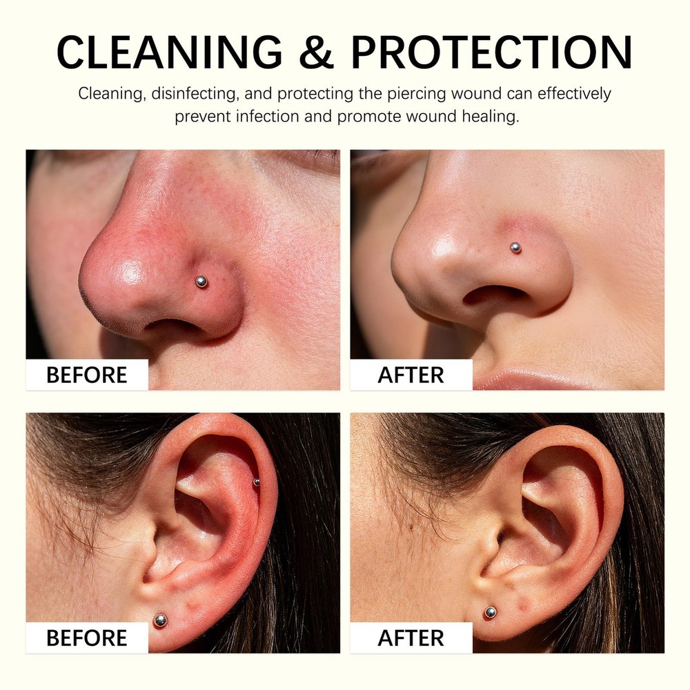 Piercing Bump Shrinking Drops Keloid Bump Remover 0.5 Fl Oz