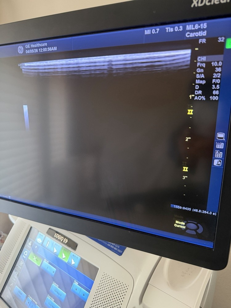 GE ML6-15 D Linear Vascular Probe , Excellent working condition,