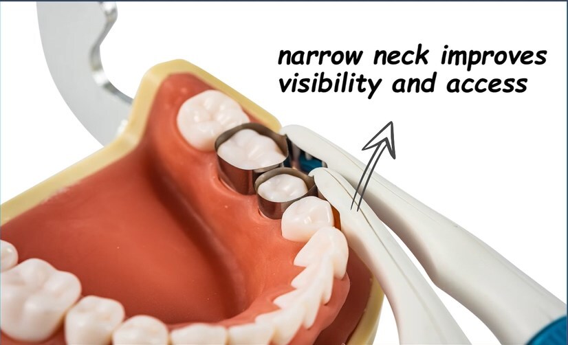 Adjust Dental Pro Matrix Bands Molar/Premolar Restoration Pre Formed 10/20/30Pcs