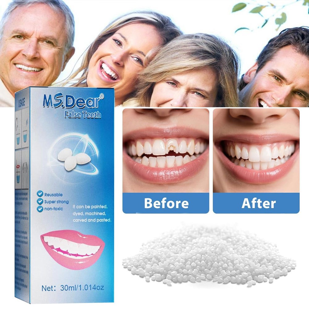 Moldable Teeth Repair Beads Kit – Temporary Filling for Broken, Missing Teeth
