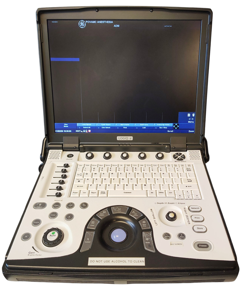 GE LOGIQ E Ultrasound System