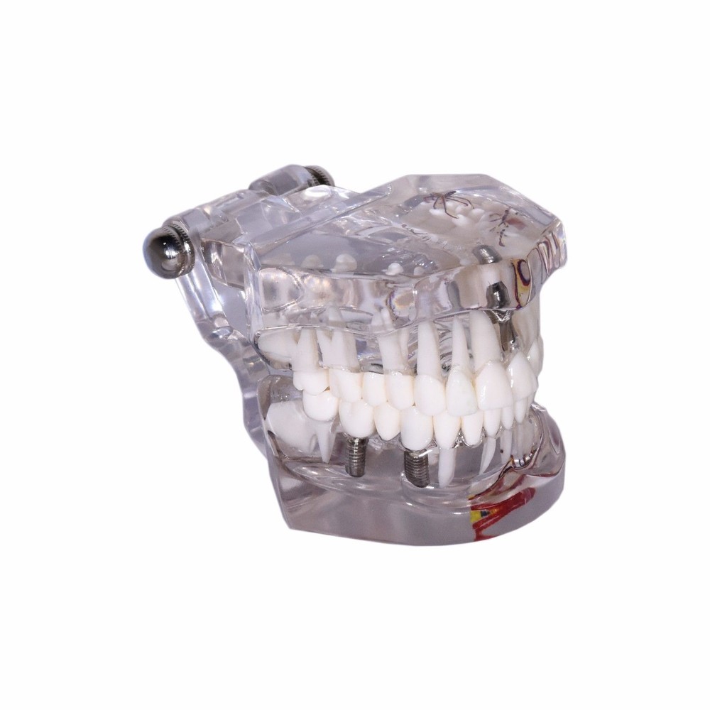 Redlands Dental Demonstration Teeth Educational Model #3003 Mixed Clear