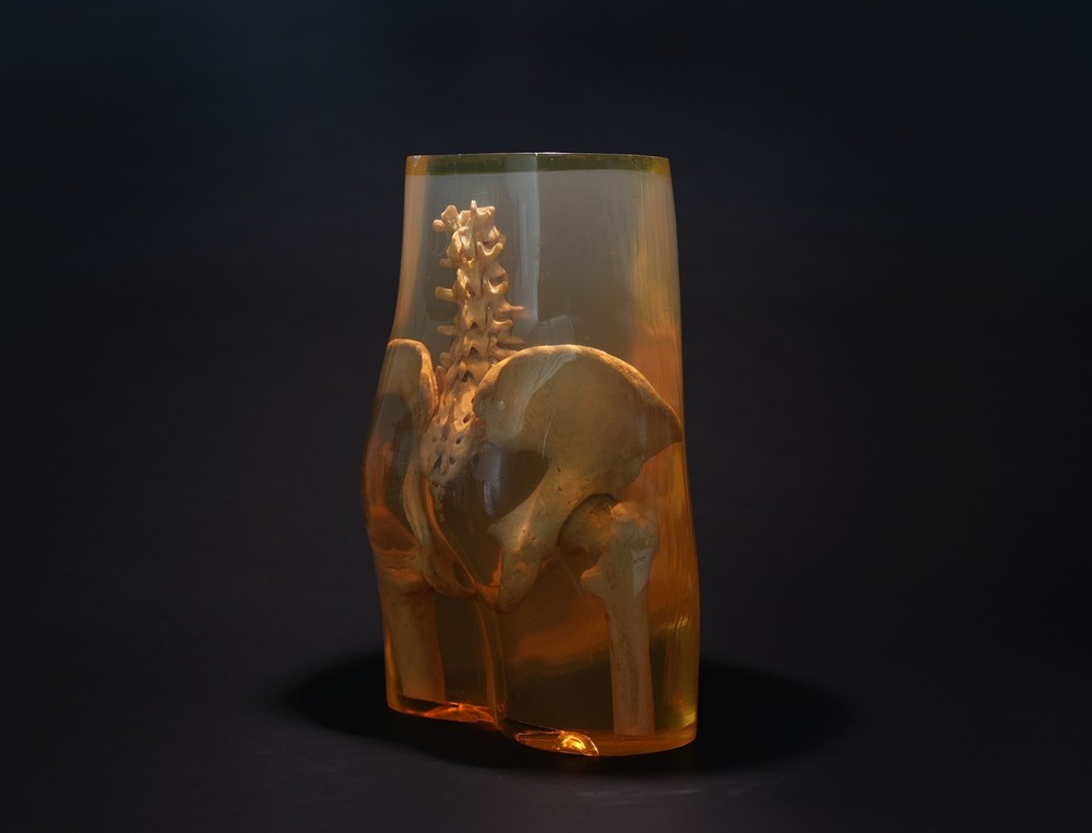 3M Xray Calibration Phantom Pelvis C.1960's
