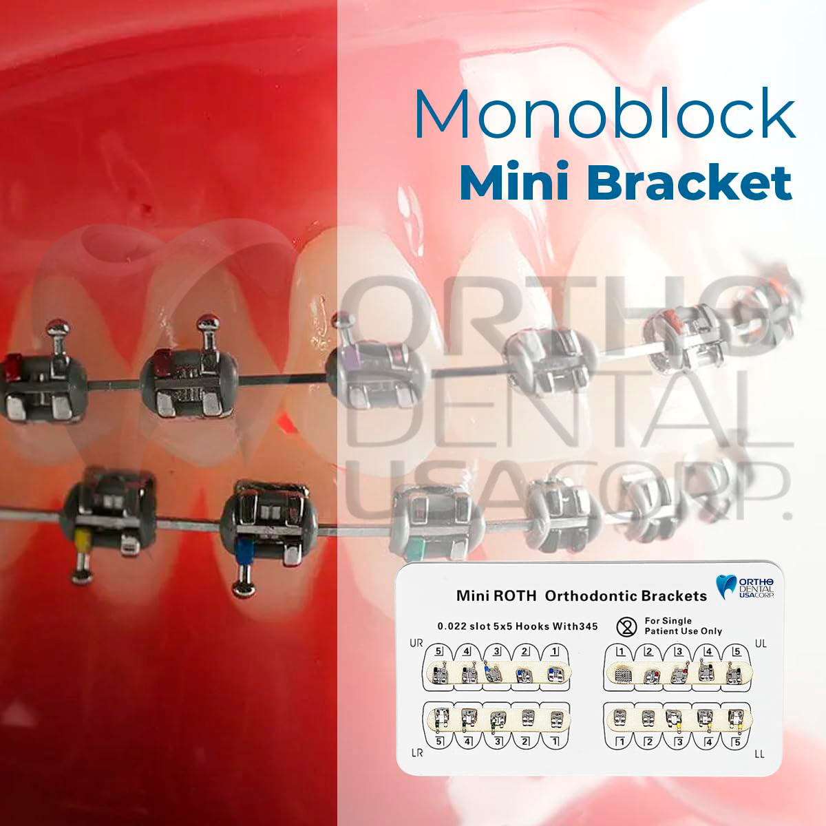 KIT Include Brackets Elastomeric Ligature Ties and bag of Wires Orthodentalusa