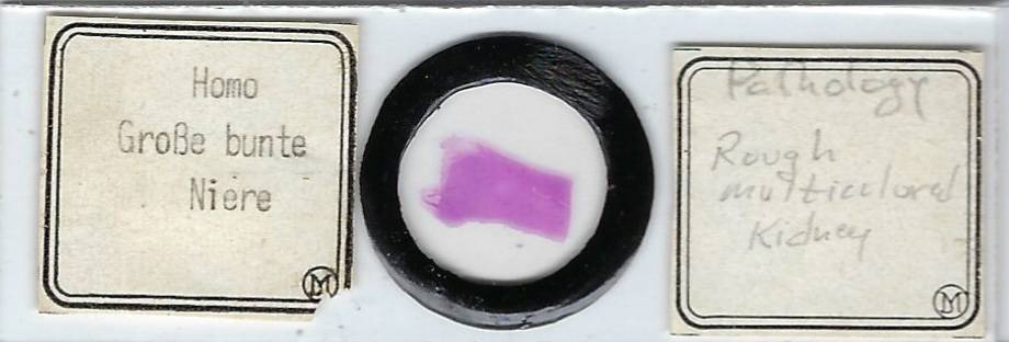 Human Kidney Pathology Microscope Slide by Moeller
