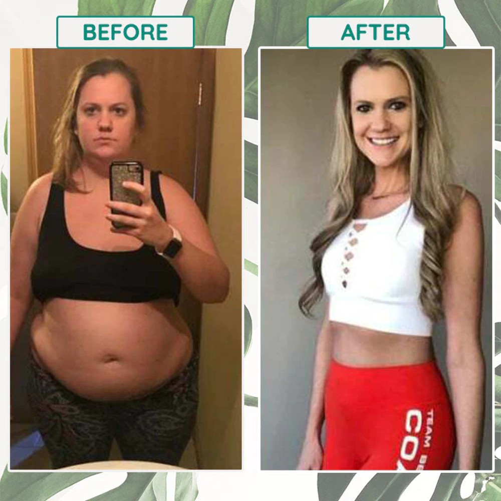 50PCS Slim Patch Weight Loss Slimming Diets Pads Detox Burn Fat Adhesive USA