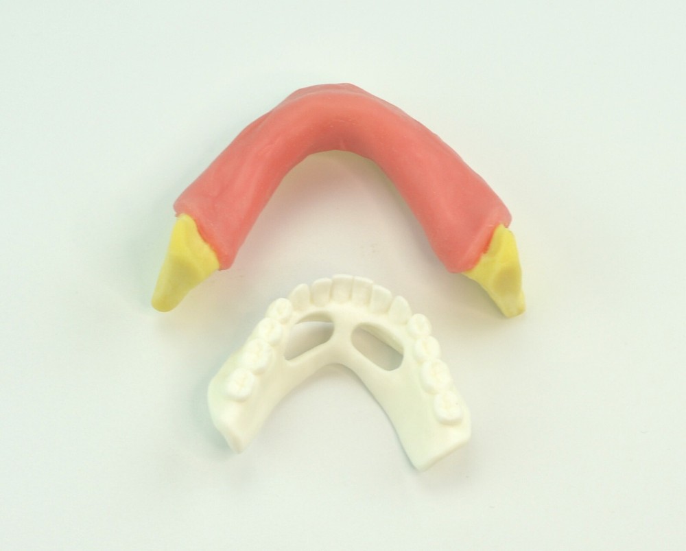 Dental Mandibular Implant Plus Denture Training Model Implant Placement
