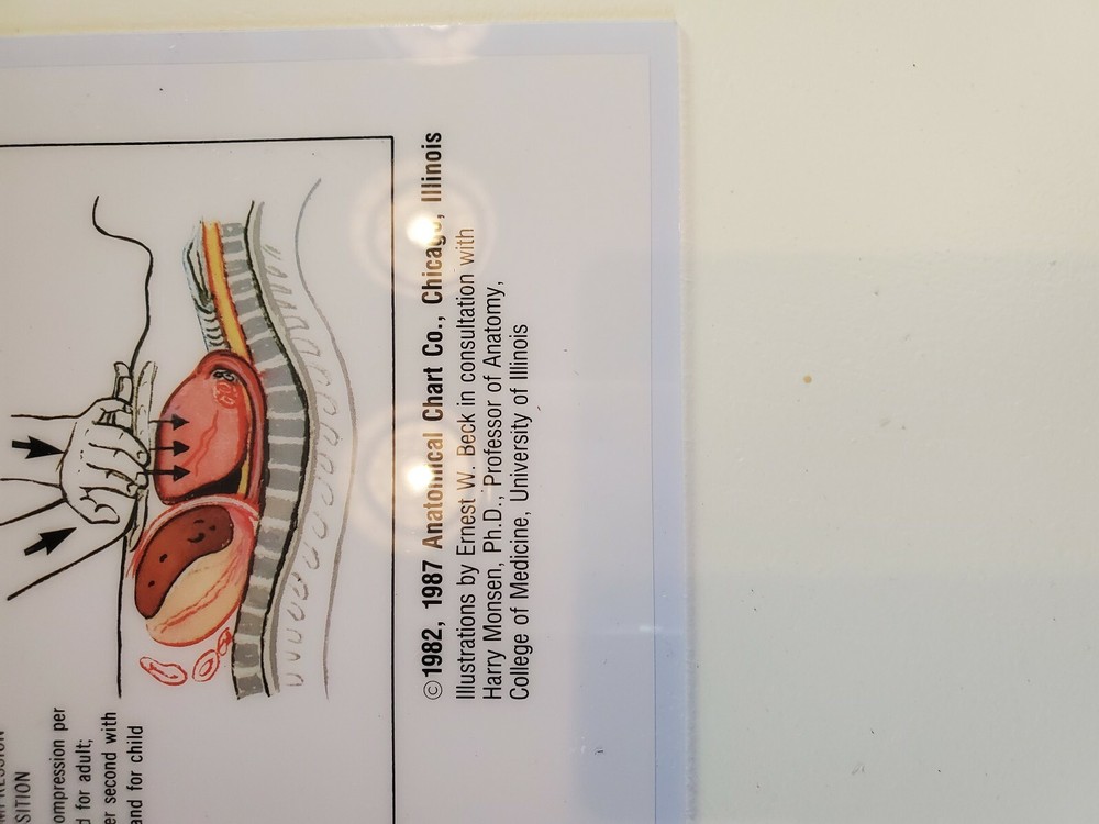 2 Medical Flip Chart Sheets Cardiovascular