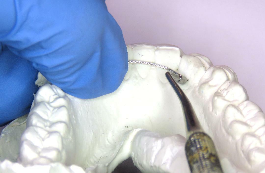 Dead Soft Flat Ortho Lingual Retainer Wire - 60" - Spool/ Roll/ Strips