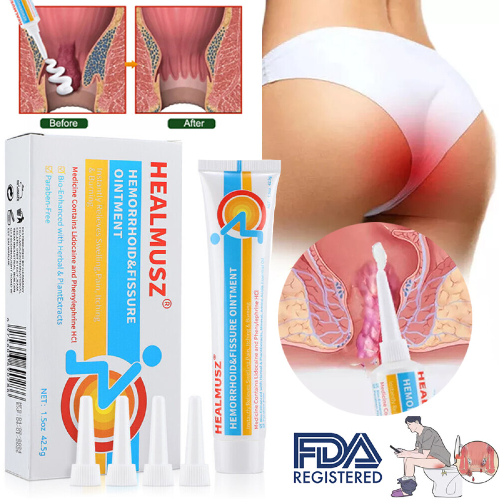 Hemorrhoids Remove Ointment Herbal Cream Relief Piles Pain Reduce Itching 42.5g