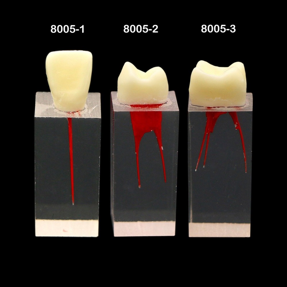 Dental Endo Root Canal Teeth Model Study Practice Block RCT Pulp Cavity