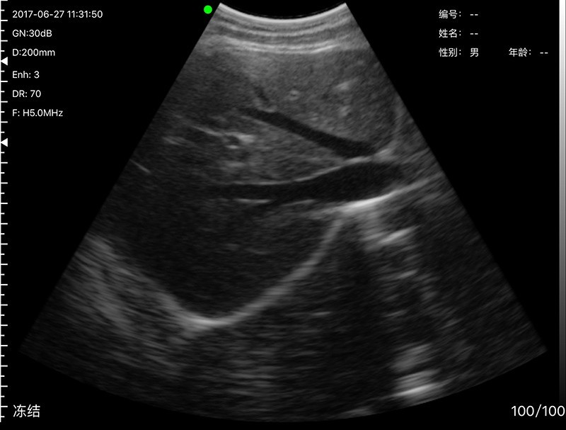 Wireless Ultrasound Probe Scanner Portable Machine Support iOS Android Windows