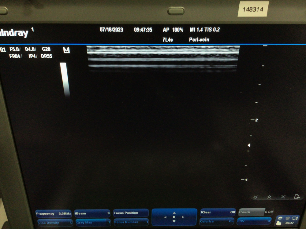 2018 Mindray 7L4s Linear Array Ultrasound Probe