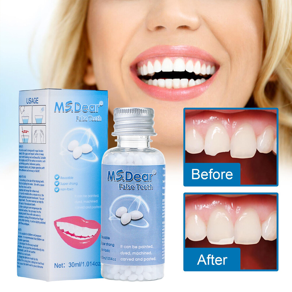 2X Temporary Tooth Repair Set False Teeth Solid Glue Teeth Gaps Denture Adhesive
