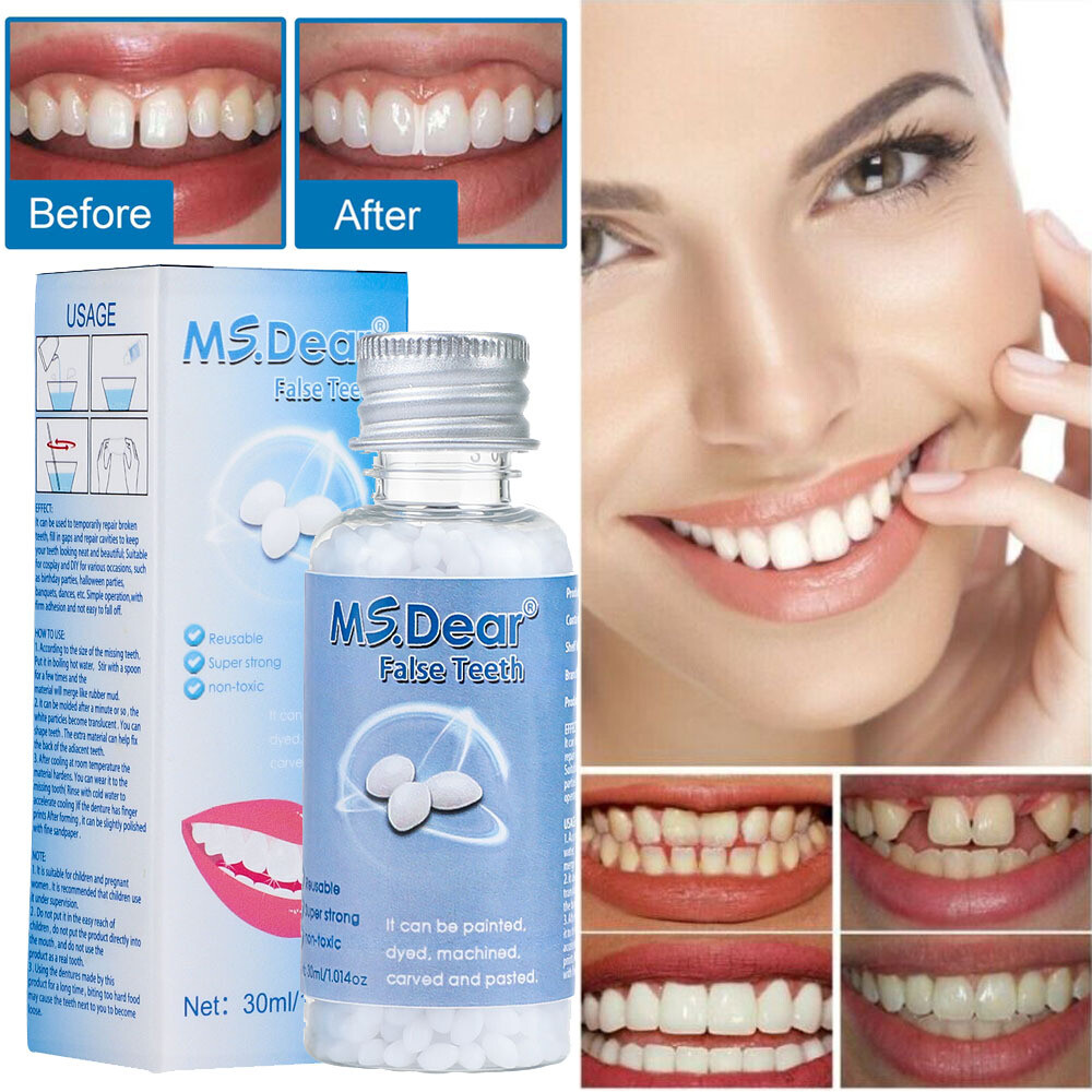 Resin False Teeth Solid Glue Temporary Tooth Repair Set Teeth And Gap Adhesive
