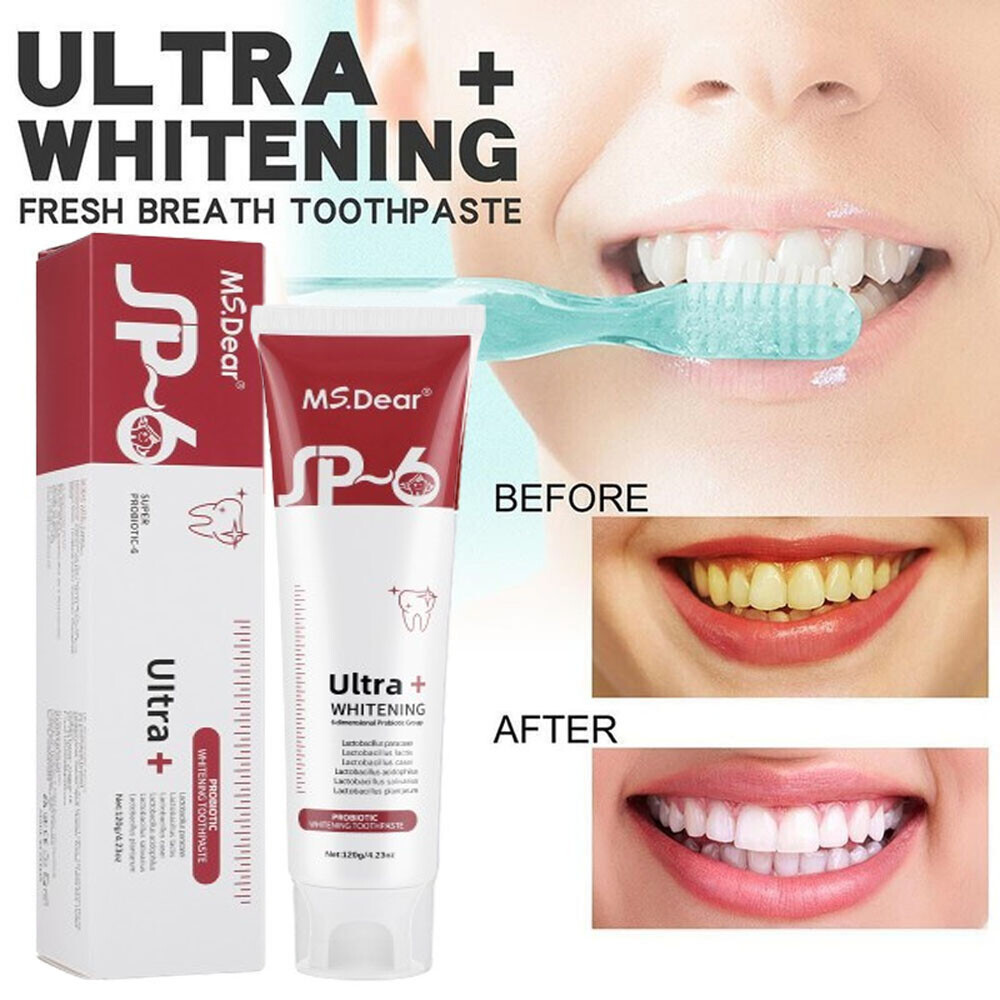 SP-6 Probiotic Toothpaste,Sp-6 Toothpaste Ultra Whitening Quick White Toothpaste