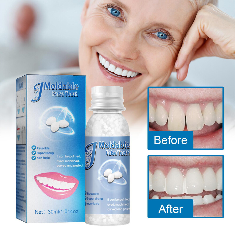 Tooth Repair Granules Temporary Kit Fitting Beads Reusable Moldable False Teeth