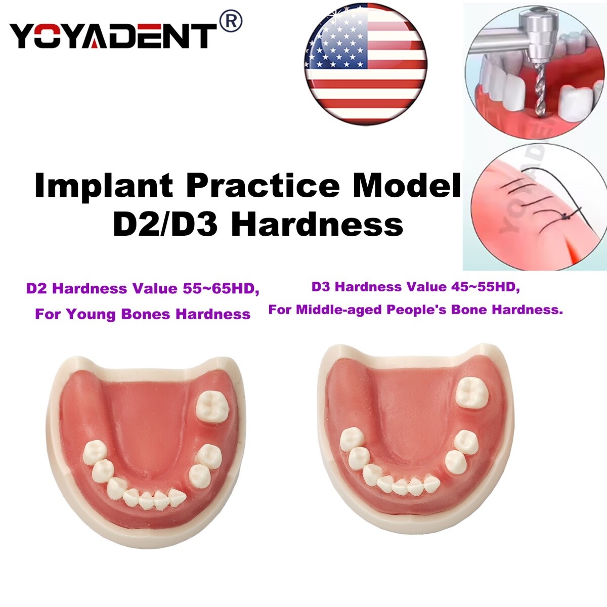 US Dental Model Implant Practice Model For Dentistry Teaching Study Soft Gums