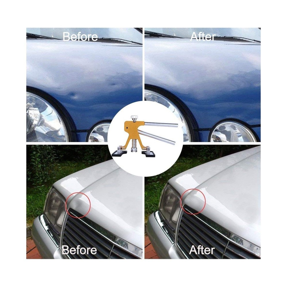 Gliston Auto Dent Puller Kit - Adjustable Golden Dent Remover Tools Paintless...