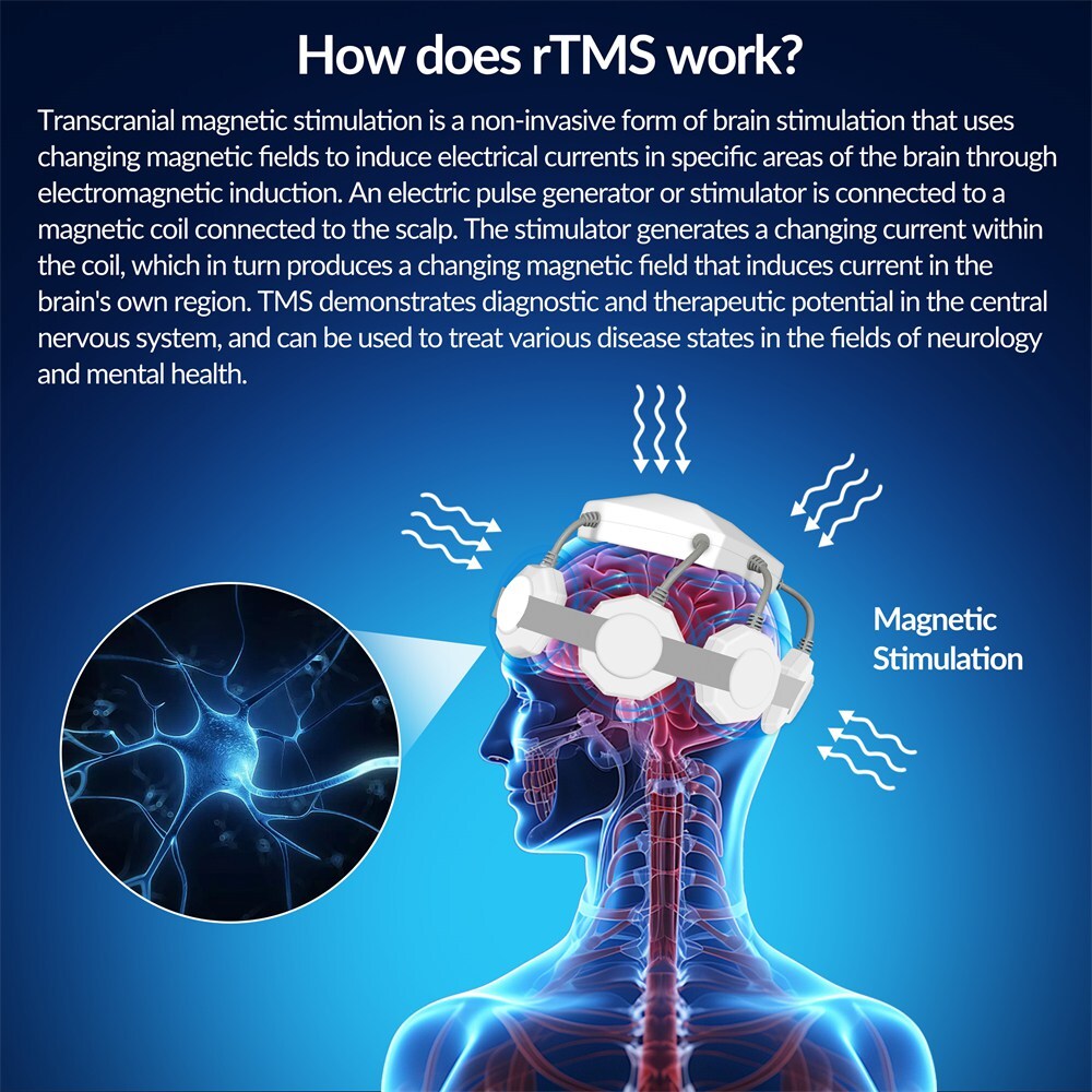 rTMS Brain Therapy Machine Magnetic Stimulation Wellness Device for Stroke