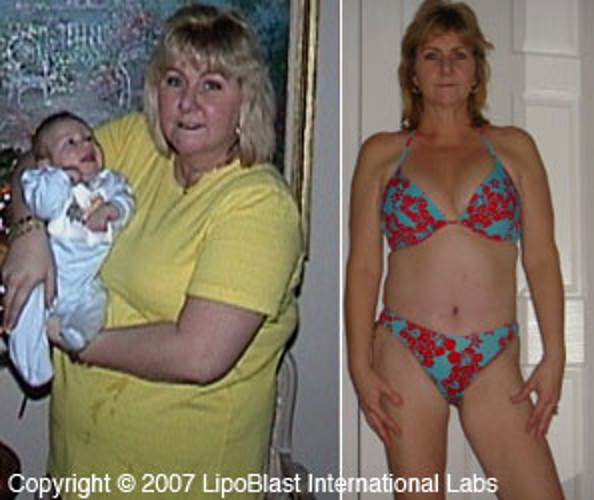 Best Diet Pills For Men & Women That Work Fast! Rapid Weight Loss Fat Burners