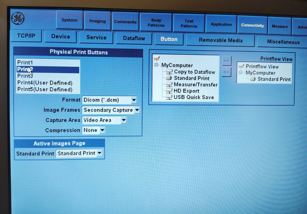 GE LOGIQ E Ultrasound System
