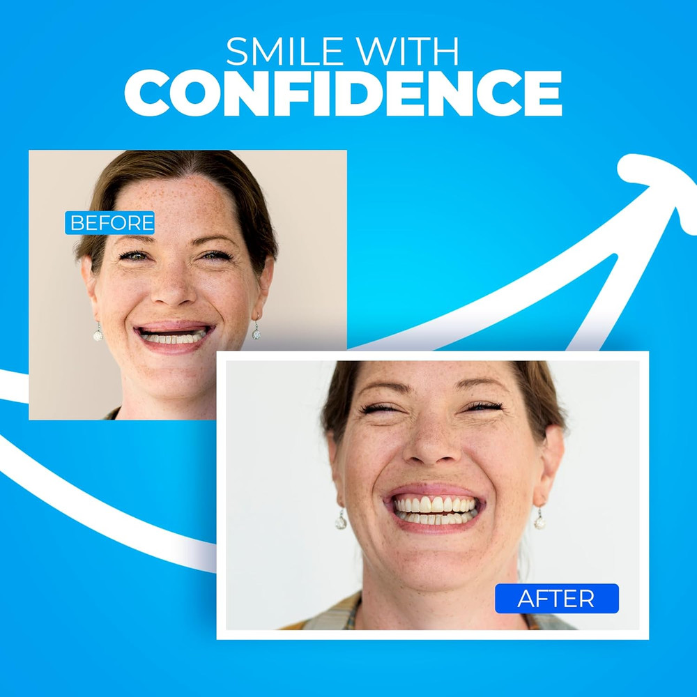 Upper Denture Boil and Bite - Comfortable, Adjustable Dentures to Replace Missin