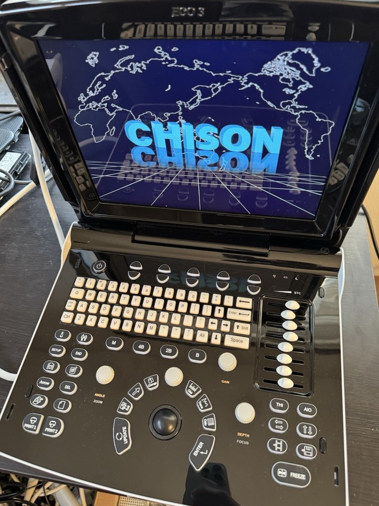 Chison Eco 3 with Convex Abdominal Probe