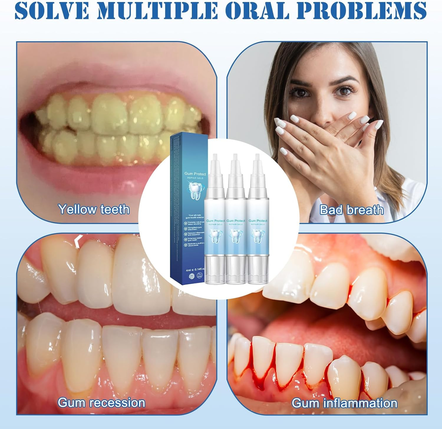 Neslemy™ Gum Shield Therapy Gel, Neslemy Gum Gel, Dentizen Gum Therapy Gel, Teet