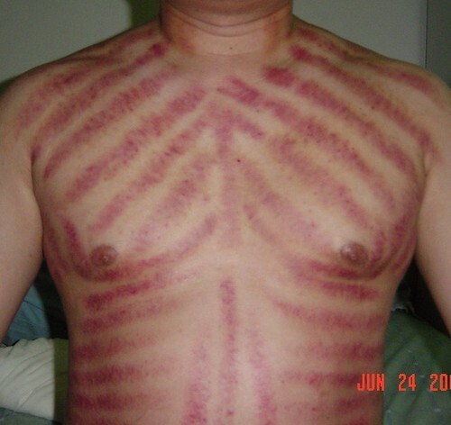 Gua Sha Tools/Cao Gio (Made in USA)