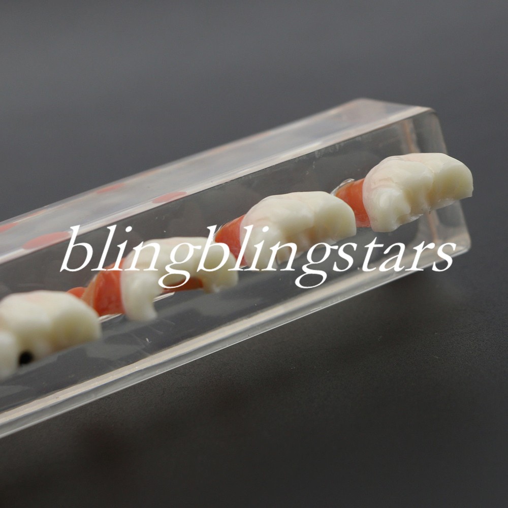 Dental Teeth Model Treatment Demonstrates Model 4 Stages Endodontic Study 4018