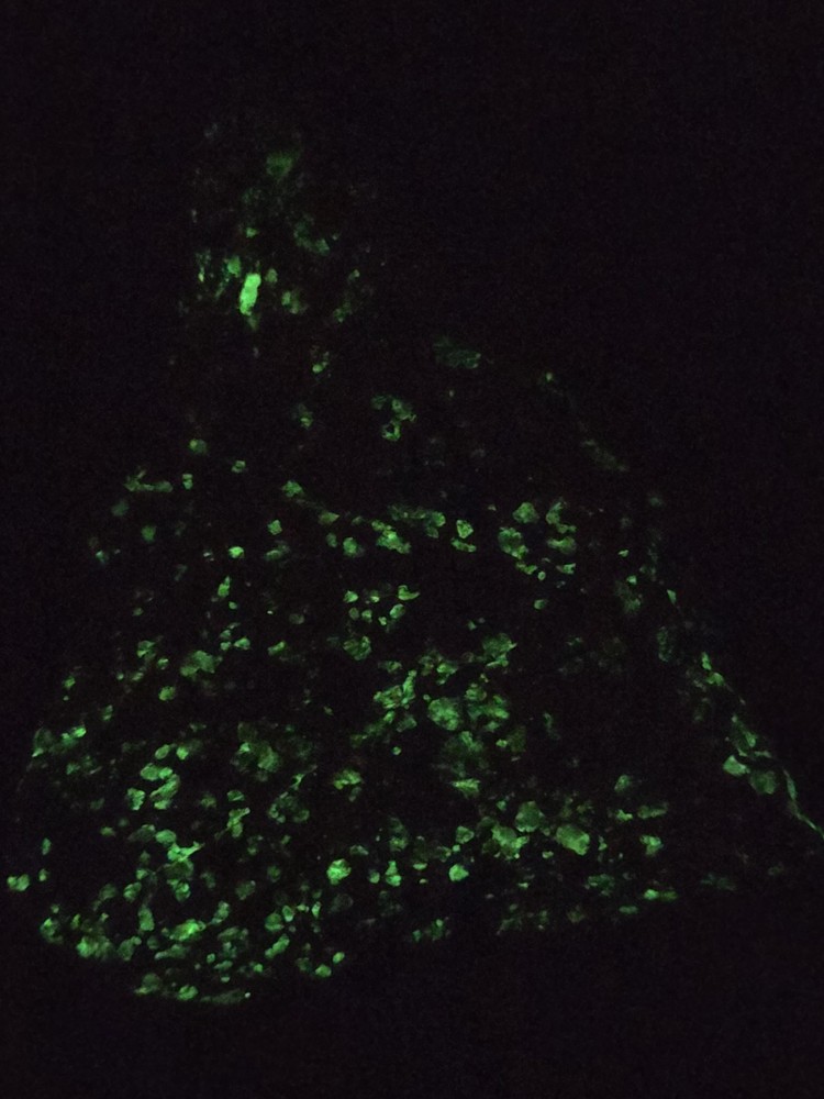 Large Phosphorescent Willemite Specimen 2 Lbs 11 Oz