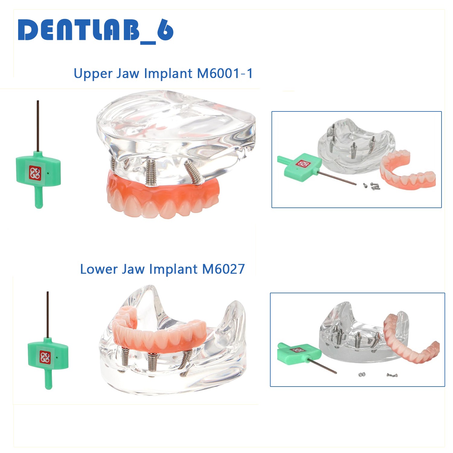 2pcs All-on-4 Dental Implant Model Upper/Lower Jaw Removable Screws Transparent