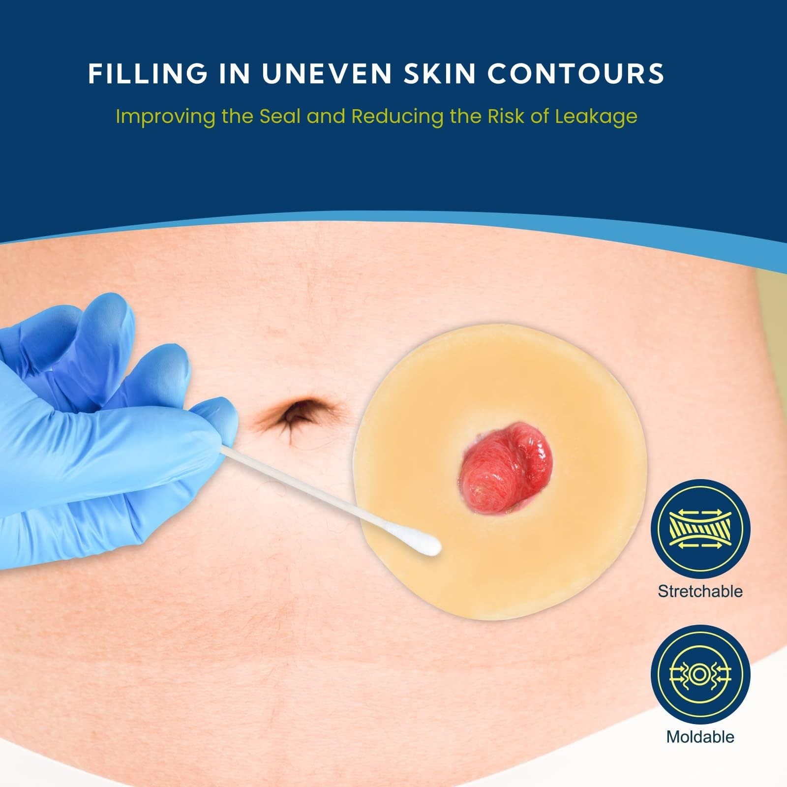 10 PCS Ostomy Barrier Rings, 2Mm Thickness Moldable Colostomy Rings, Medical Gra