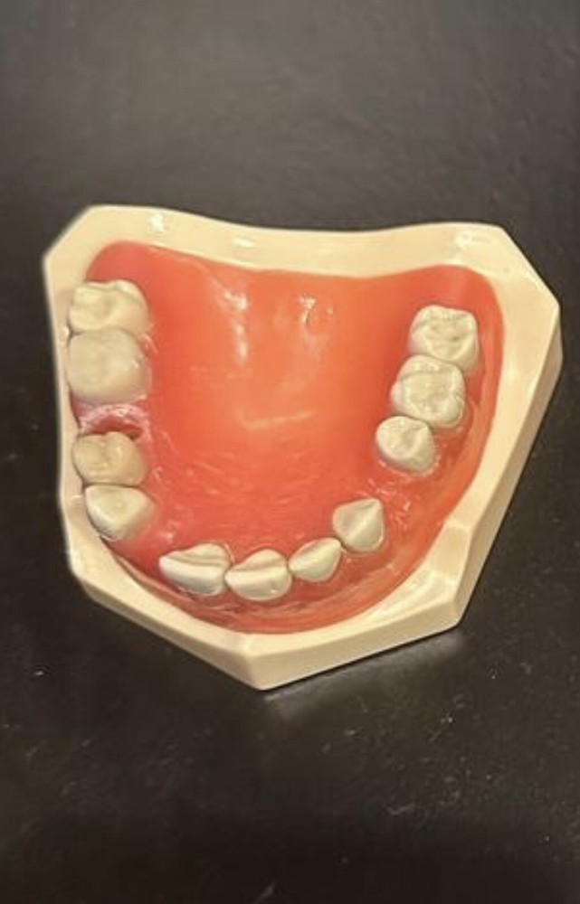 Maxillary Dental Typodont With Gaps