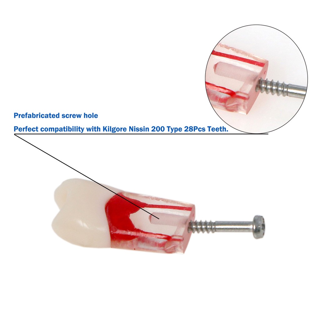 10Pcs Dental Root Canal Study Teeth Model for Endodontic Rotary Files Practice