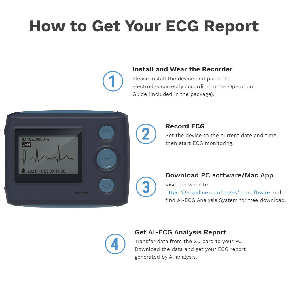 12 Lead Holter Monitor Recording 24h ECG and Heart Rate AI Analysis Abnormal ECG