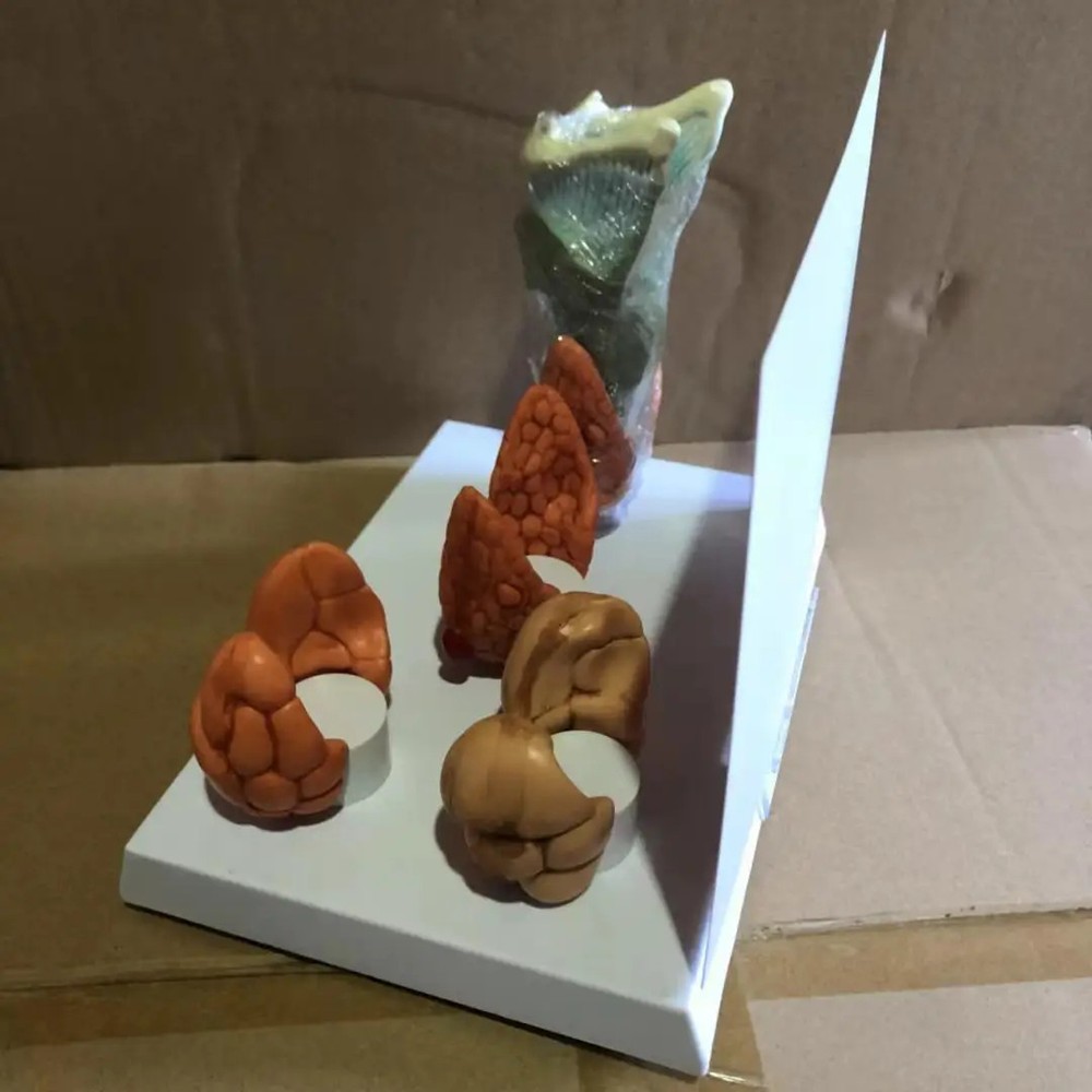 Thyroid Disease Lesion Anatomical Model Thyroid Anatomy Teaching Mode