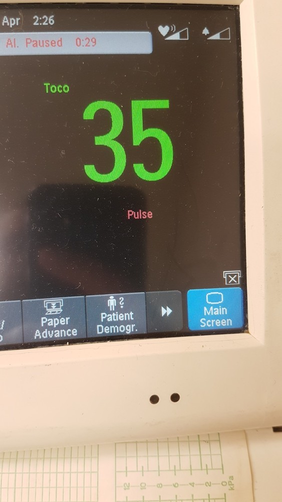 Philips TOCO MP Transducer M2734B